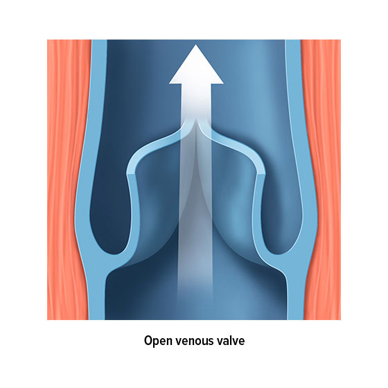 Open venous valve Open venous valve