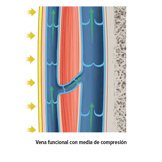 Vena funcional con media de compresión Vena funcional con media de compresión